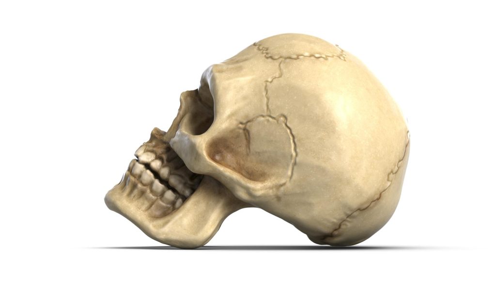Facial bone fractures